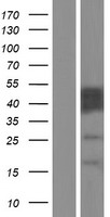 CABYR Protein - Western validation with an anti-DDK antibody * L: Control HEK293 lysate R: Over-expression lysate