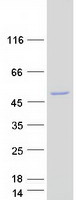 CABYR Protein - Purified recombinant protein CABYR was analyzed by SDS-PAGE gel and Coomassie Blue Staining
