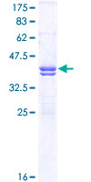 CACNA1C / Cav1.2 Protein - 12.5% SDS-PAGE Stained with Coomassie Blue.