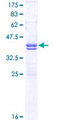 CACNA1C / Cav1.2 Protein - 12.5% SDS-PAGE Stained with Coomassie Blue.