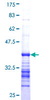 CACNA1E / Cav2.3 Protein - 12.5% SDS-PAGE Stained with Coomassie Blue.