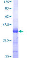 CACNA1F / Cav1.4 Protein - 12.5% SDS-PAGE Stained with Coomassie Blue.