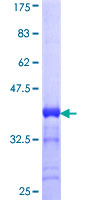 CACNA1S / Cav1.1 Protein - 12.5% SDS-PAGE Stained with Coomassie Blue.