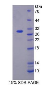 CACNA1S / Cav1.1 Protein - Recombinant Calcium Channel, Voltage Dependent, L-Type, Alpha 1S Subunit (CACNa1S) by SDS-PAGE