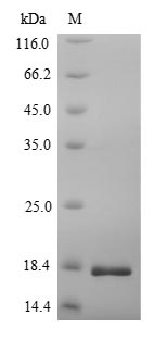CACNA2D1 Protein - (Tris-Glycine gel) Discontinuous SDS-PAGE (reduced) with 5% enrichment gel and 15% separation gel.