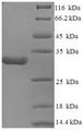 CACNA2D1 Protein - (Tris-Glycine gel) Discontinuous SDS-PAGE (reduced) with 5% enrichment gel and 15% separation gel.