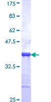 CACNA2D2 Protein - 12.5% SDS-PAGE Stained with Coomassie Blue.