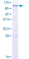 CACNB1 Protein - 12.5% SDS-PAGE of human CACNB1 stained with Coomassie Blue