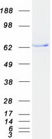 CACNB1 Protein - Purified recombinant protein CACNB1 was analyzed by SDS-PAGE gel and Coomassie Blue Staining