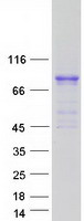 CACNB1 Protein - Purified recombinant protein CACNB1 was analyzed by SDS-PAGE gel and Coomassie Blue Staining