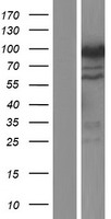 CACNB2 Protein - Western validation with an anti-DDK antibody * L: Control HEK293 lysate R: Over-expression lysate