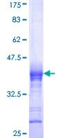 CACNB2 Protein - 12.5% SDS-PAGE Stained with Coomassie Blue.