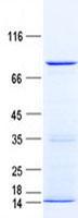 CACNB2 Protein