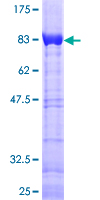 CACNB3 / Cavbeta3 Protein - 12.5% SDS-PAGE of human CACNB3 stained with Coomassie Blue