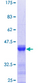 CACNB4 Protein - 12.5% SDS-PAGE Stained with Coomassie Blue.