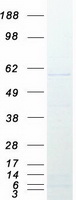 CACNB4 Protein - Purified recombinant protein CACNB4 was analyzed by SDS-PAGE gel and Coomassie Blue Staining