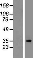 CACNG2 / Stargazin Protein - Western validation with an anti-DDK antibody * L: Control HEK293 lysate R: Over-expression lysate