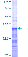 CACNG3 Protein - 12.5% SDS-PAGE Stained with Coomassie Blue.