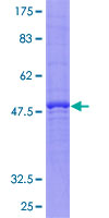 CACNG5 Protein - 12.5% SDS-PAGE of human CACNG5 stained with Coomassie Blue
