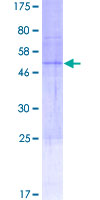 CACNG6 Protein - 12.5% SDS-PAGE of human CACNG6 stained with Coomassie Blue