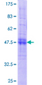 CACNG7 Protein - 12.5% SDS-PAGE of human CACNG7 stained with Coomassie Blue