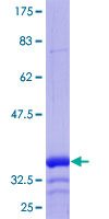 CACNG7 Protein - 12.5% SDS-PAGE Stained with Coomassie Blue.