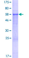CACUL1 / Cullin Protein - 12.5% SDS-PAGE of human C10orf46 stained with Coomassie Blue