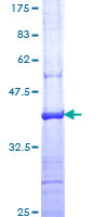 CACUL1 / Cullin Protein - 12.5% SDS-PAGE Stained with Coomassie Blue