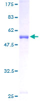 CACYBP Protein - 12.5% SDS-PAGE of human CACYBP stained with Coomassie Blue