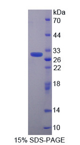 CACYBP Protein - Recombinant  Calcyclin Binding Protein By SDS-PAGE