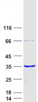 CACYBP Protein - Purified recombinant protein CACYBP was analyzed by SDS-PAGE gel and Coomassie Blue Staining