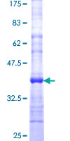 CADPS Protein - 12.5% SDS-PAGE Stained with Coomassie Blue.