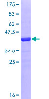 CAGE1 / Cancer Antigen 1 Protein - 12.5% SDS-PAGE Stained with Coomassie Blue.