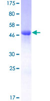 CALB1 / Calbindin Protein - 12.5% SDS-PAGE of human CALB1 stained with Coomassie Blue