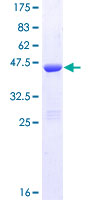CALB2 / Calretinin Protein - 12.5% SDS-PAGE of human CALB2 stained with Coomassie Blue