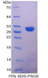 CALB2 / Calretinin Protein - Recombinant Calretinin By SDS-PAGE