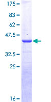 CALCA Protein - 12.5% SDS-PAGE of human CALCA stained with Coomassie Blue