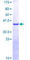 CALCA Protein - 12.5% SDS-PAGE of human CALCA stained with Coomassie Blue