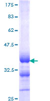 CALCA Protein - 12.5% SDS-PAGE Stained with Coomassie Blue.