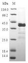 CALCB Protein - (Tris-Glycine gel) Discontinuous SDS-PAGE (reduced) with 5% enrichment gel and 15% separation gel.