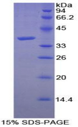 Calcineurin Protein - Recombinant Calcineurin By SDS-PAGE
