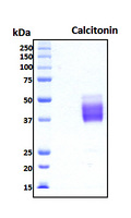 Calcitonin Protein - SDS-PAGE under reducing conditions and visualized by Coomassie blue staining