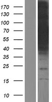 CALCOCO1 / CoCoa Protein - Western validation with an anti-DDK antibody * L: Control HEK293 lysate R: Over-expression lysate