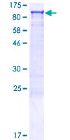CALCOCO1 / CoCoa Protein - 12.5% SDS-PAGE of human CALCOCO1 stained with Coomassie Blue