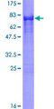 CALCOCO2 Protein - 12.5% SDS-PAGE of human CALCOCO2 stained with Coomassie Blue