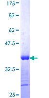 CALCOCO2 Protein - 12.5% SDS-PAGE Stained with Coomassie Blue.