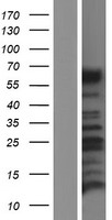 CALCR / Calcitonin Receptor Protein - Western validation with an anti-DDK antibody * L: Control HEK293 lysate R: Over-expression lysate