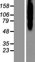 CALCR / Calcitonin Receptor Protein - Western validation with an anti-DDK antibody * L: Control HEK293 lysate R: Over-expression lysate