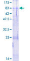 CALCR / Calcitonin Receptor Protein - 12.5% SDS-PAGE of human CALCR stained with Coomassie Blue