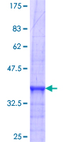 CALCR / Calcitonin Receptor Protein - 12.5% SDS-PAGE Stained with Coomassie Blue.